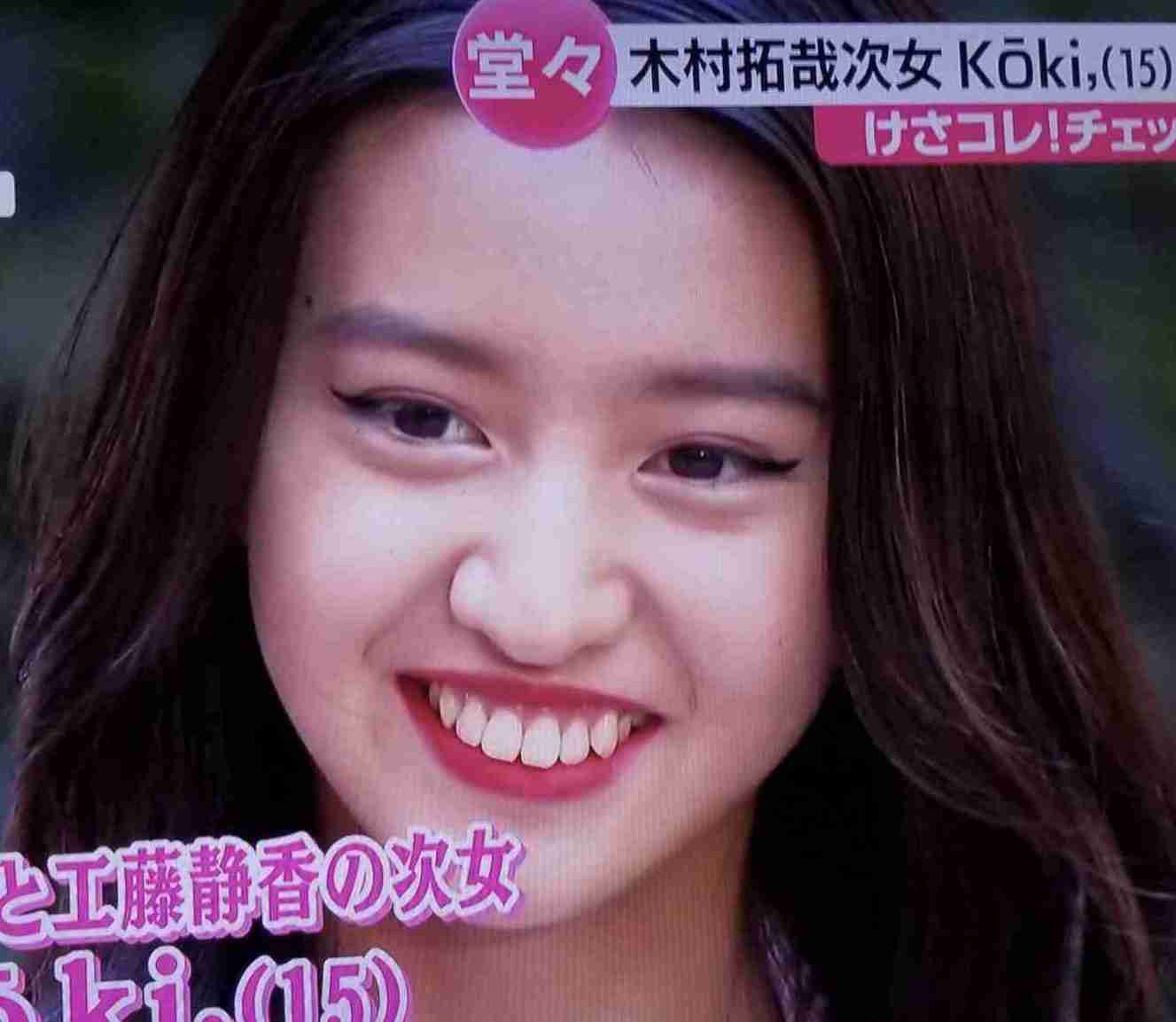 鼻の特徴的な人集まれ!