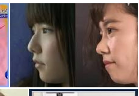 鼻の特徴的な人集まれ!