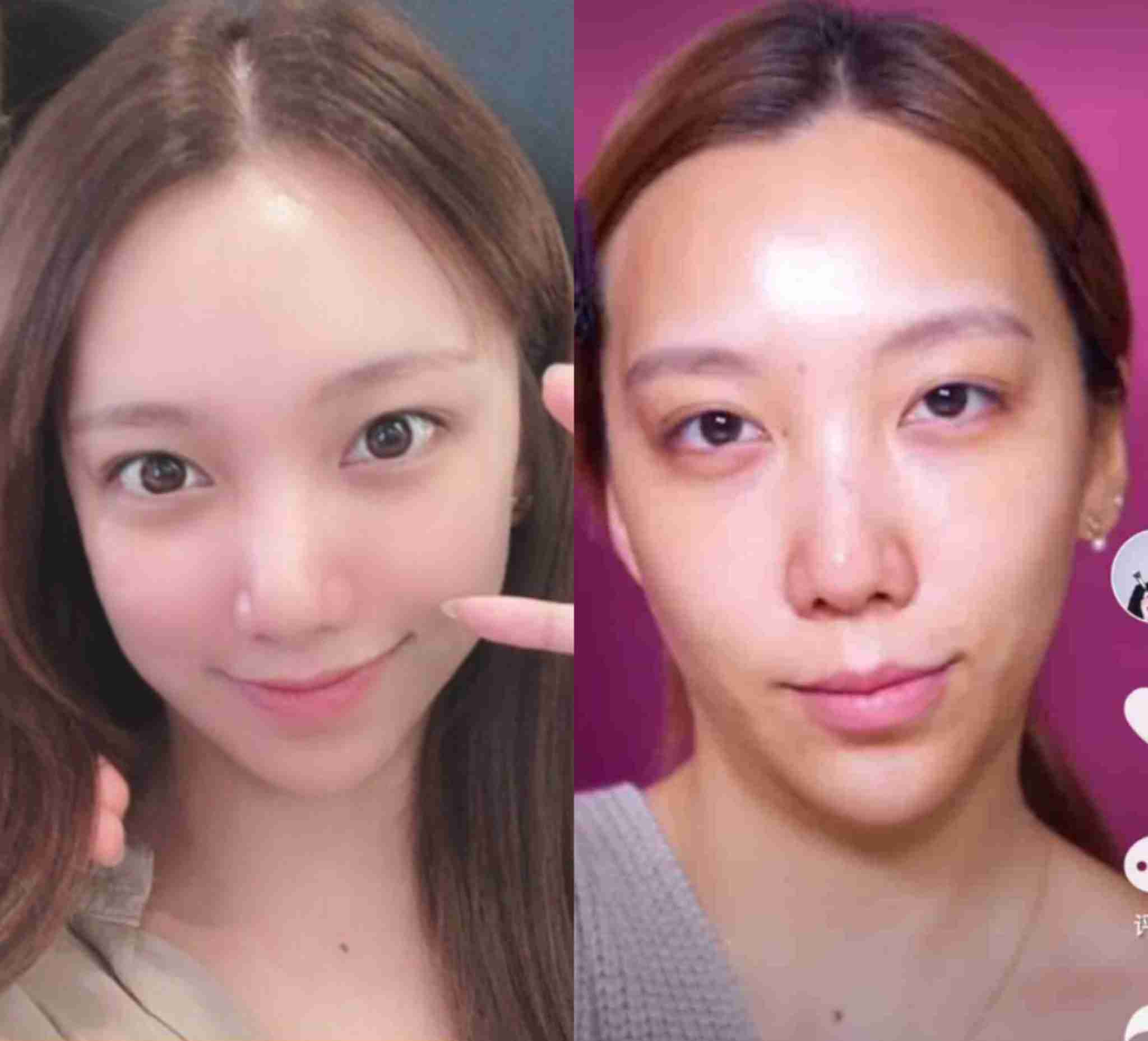 思ったより消えずに残ってる芸能人