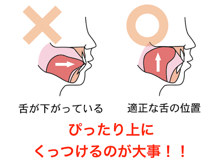 イビキの改善方法