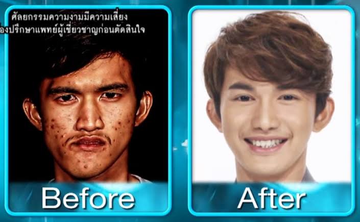 正直顔が変わりすぎだと思う男性芸能人