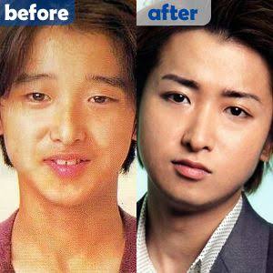 正直顔が変わりすぎだと思う男性芸能人