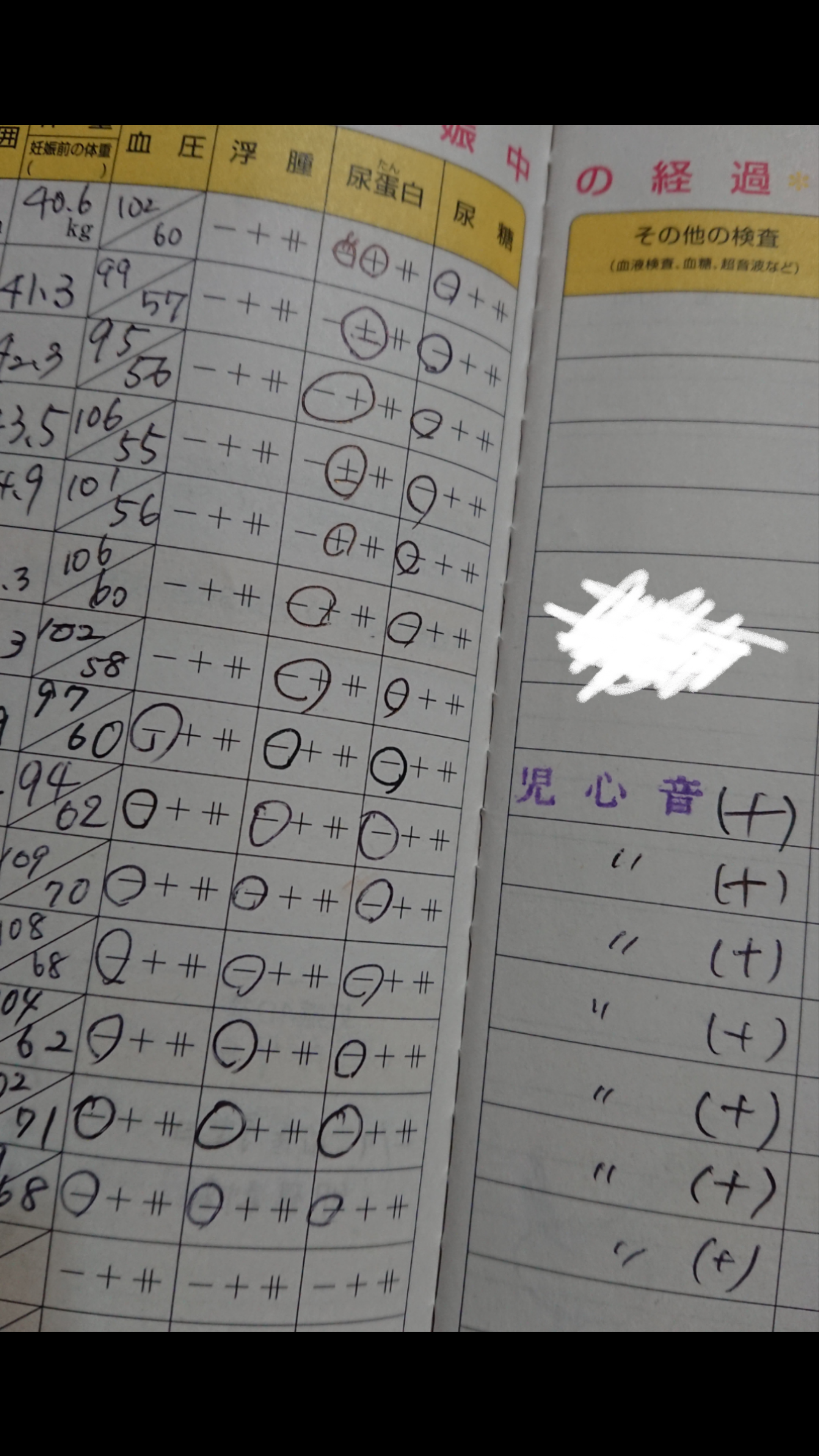 日本人女性のやせすぎは危険レベル…なぜ進んで健康を犠牲にするのか