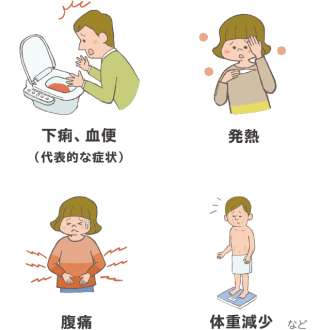 潰瘍性大腸炎の方❗️