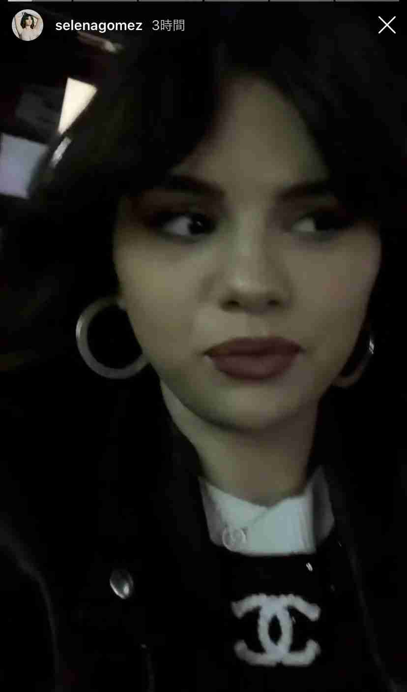 ライム病告白のジャスティン・ビーバー、顔つきの変化に心配の声