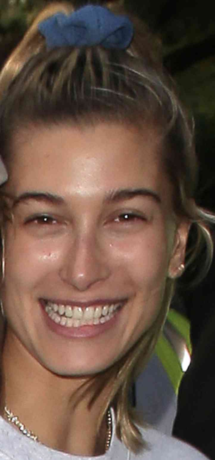 ライム病告白のジャスティン・ビーバー、顔つきの変化に心配の声