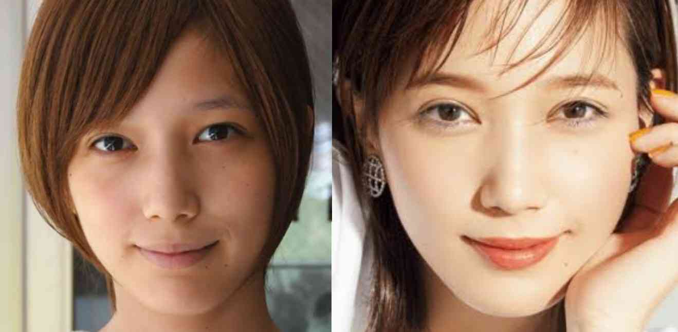 芸能人の整形について真面目に語りたい ガールズちゃんねる Girls Channel