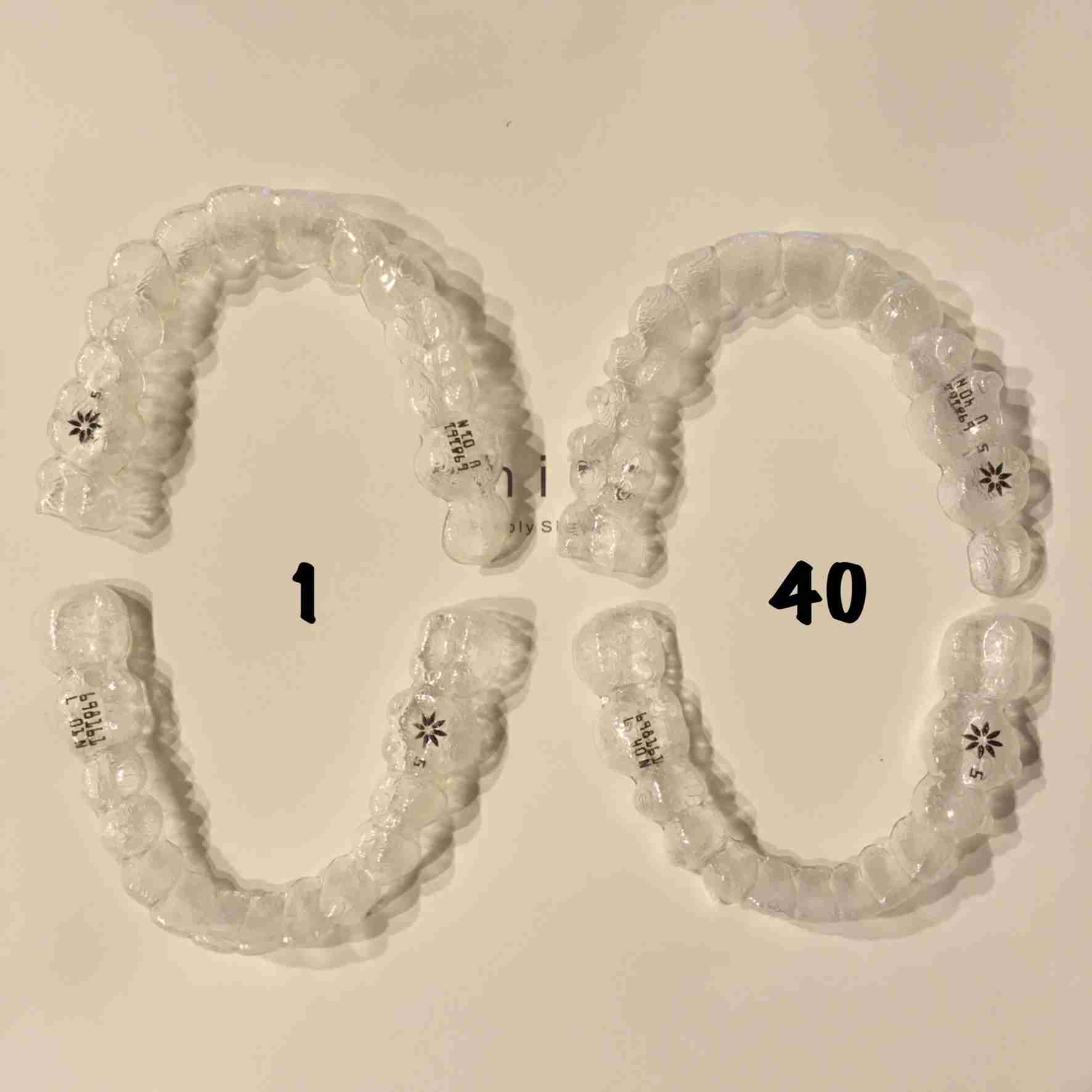 30歳以上で始める歯科矯正