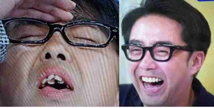 30歳以上で始める歯科矯正