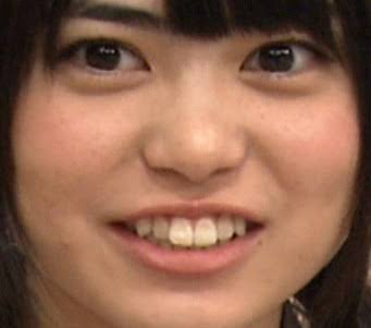 30歳以上で始める歯科矯正