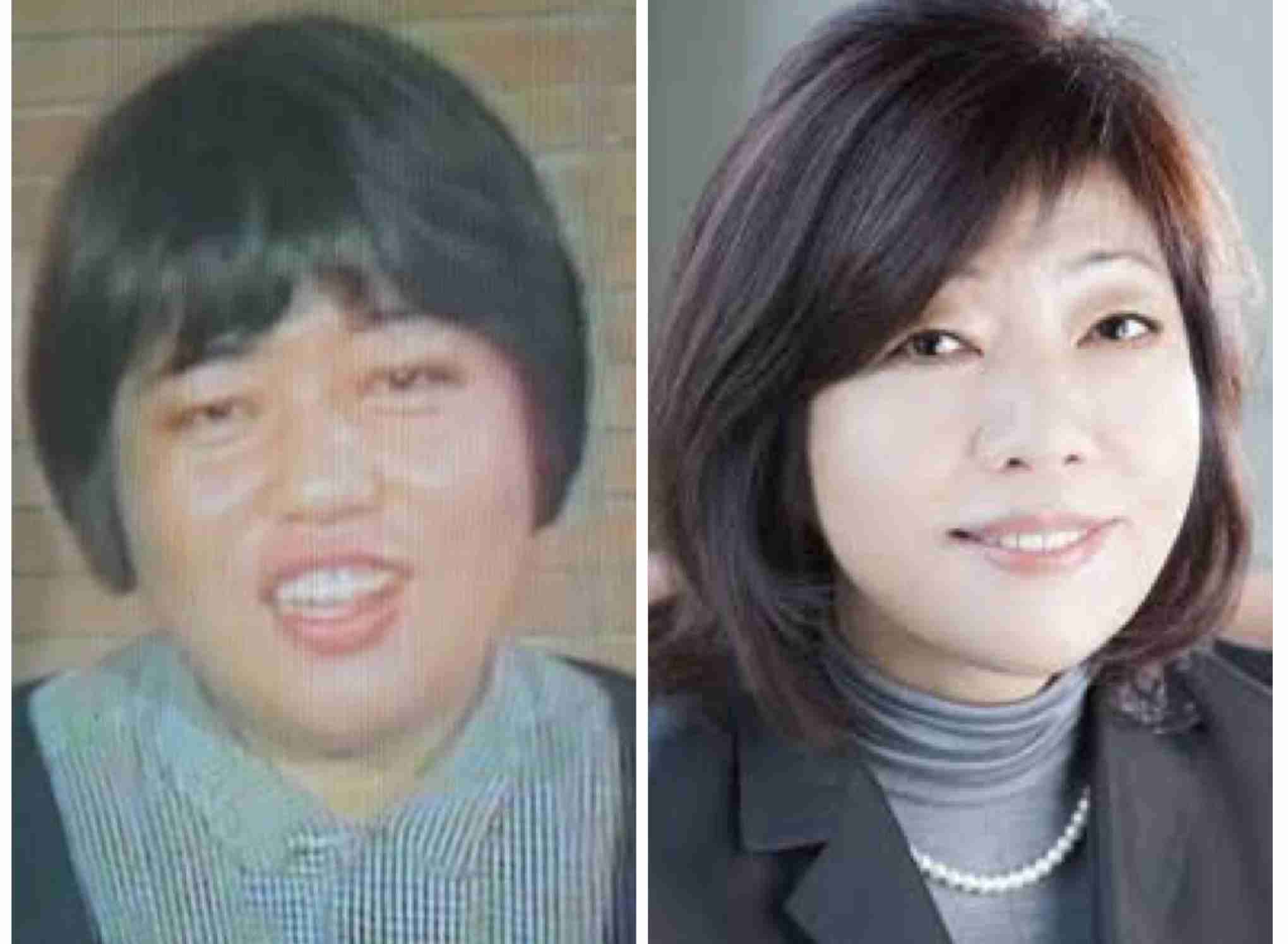 30歳以上で始める歯科矯正