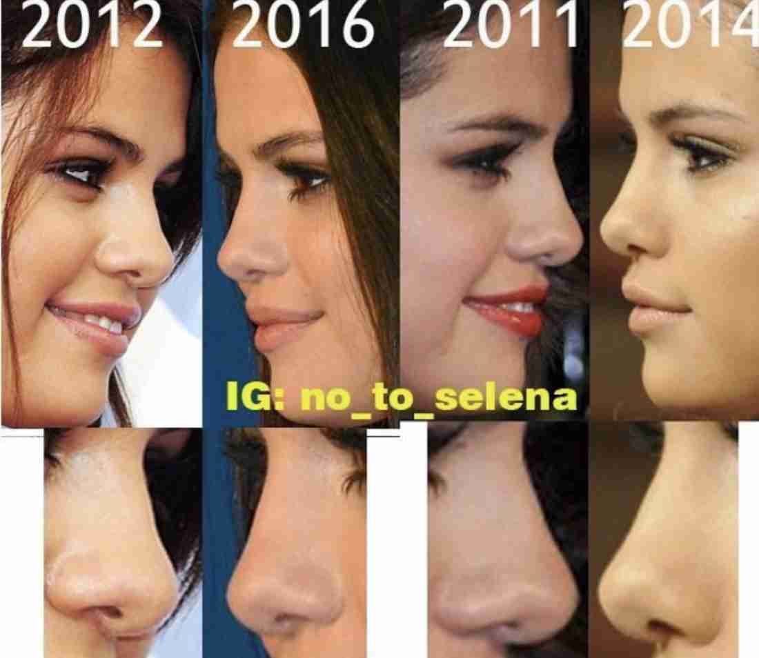 セレーナ・ゴメス、ジャスティン・ビーバーと決別宣言も元恋人間で「ありがちなミス」を犯す