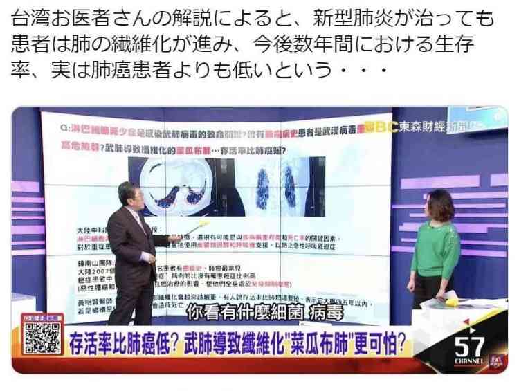 「新型コロナウイルスの再感染は致死的」医師の動画に批判、専門家「信用しないで」