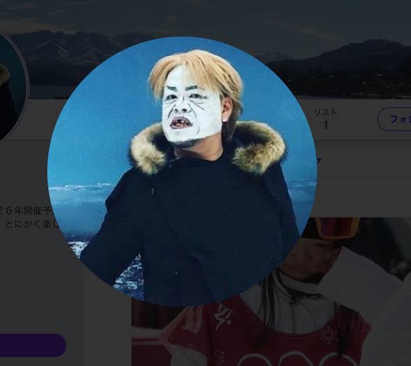 GLAYの画像を貼ると語尾にTERUがついたコメントが返ってくるトピ