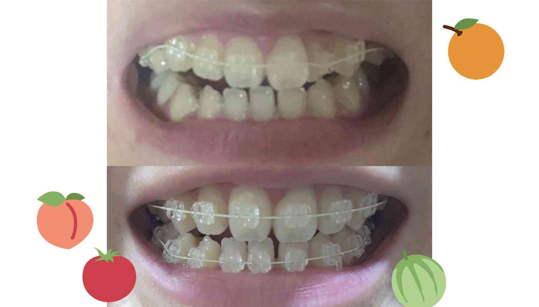 何フェチですか？