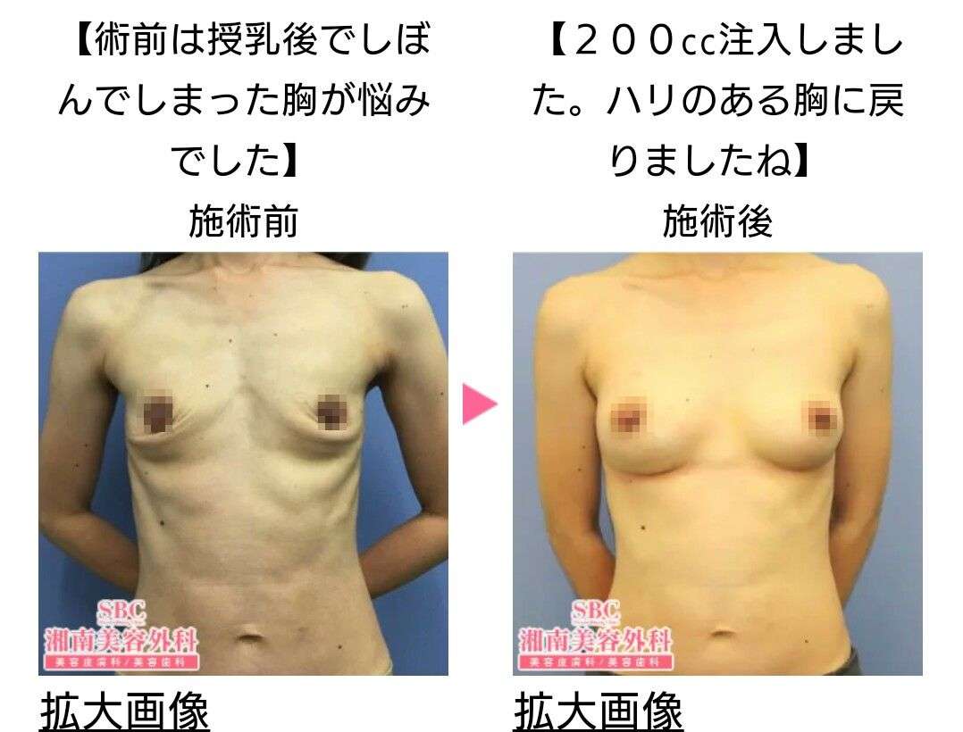 【ものによっては閲覧注意】私が衝撃を受けた画像を貼るトピ