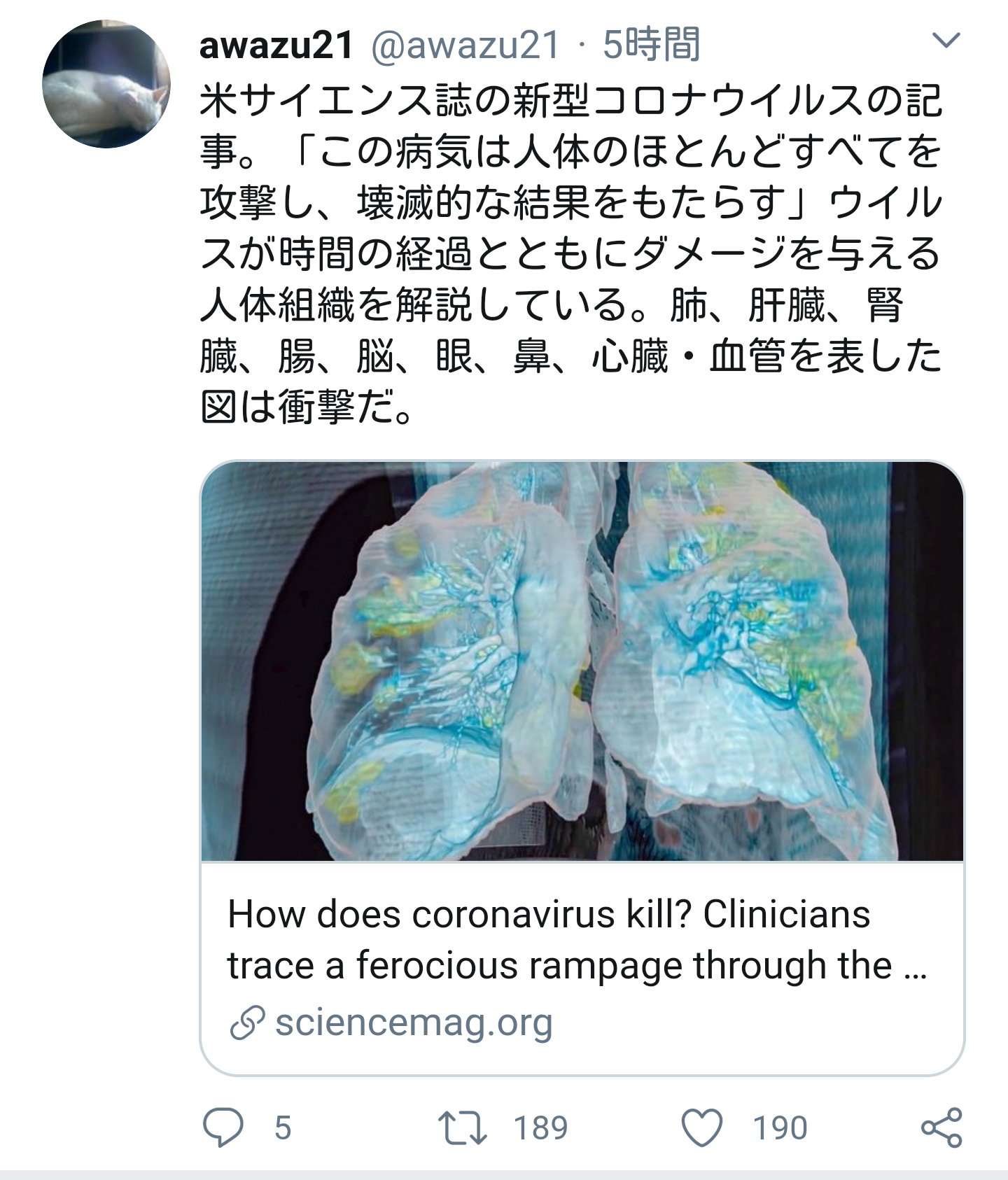 【ものによっては閲覧注意】私が衝撃を受けた画像を貼るトピ