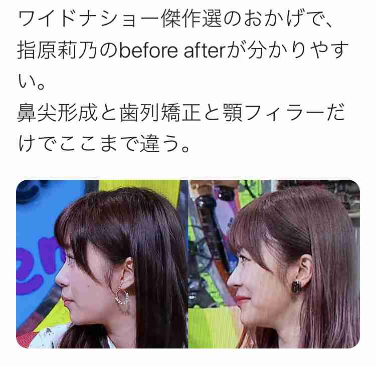 【さっしー】指原莉乃ちゃん好きな人【集合】