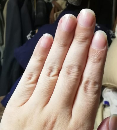 手・指・爪を綺麗にしたい