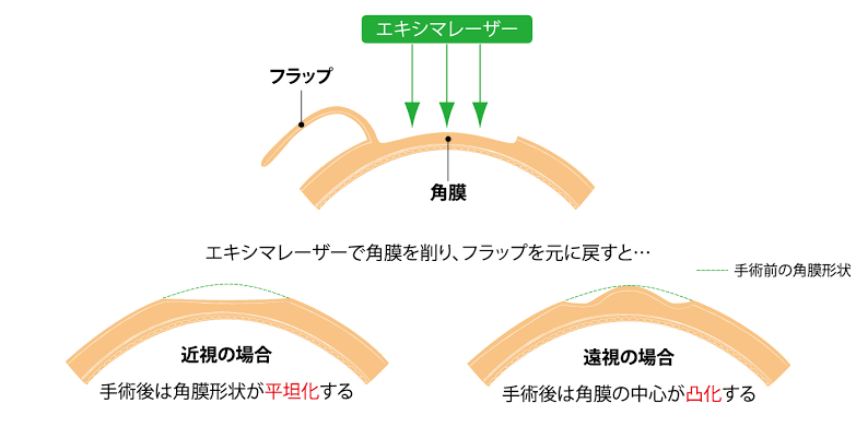20代最後の年、何がしたいですか？何をしましたか？