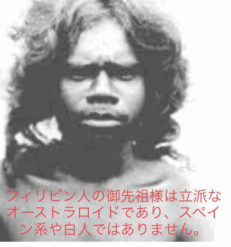 国内14年ぶり狂犬病発症　来日者、フィリピンで感染か―愛知・豊橋
