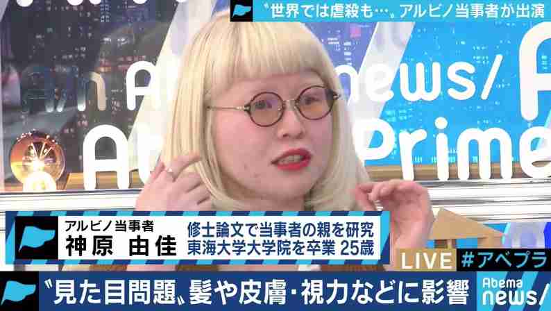 瞳の色がブルー＆ブラウン　神秘的な美しさを持つアルビノの11歳少女（露）