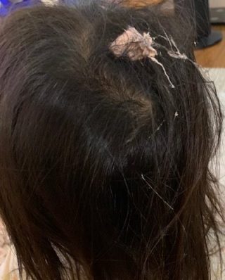 【閲覧注意】ストレスを感じそうな画像を貼ってしまうトピ