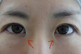 蒙古襞について語るトピ