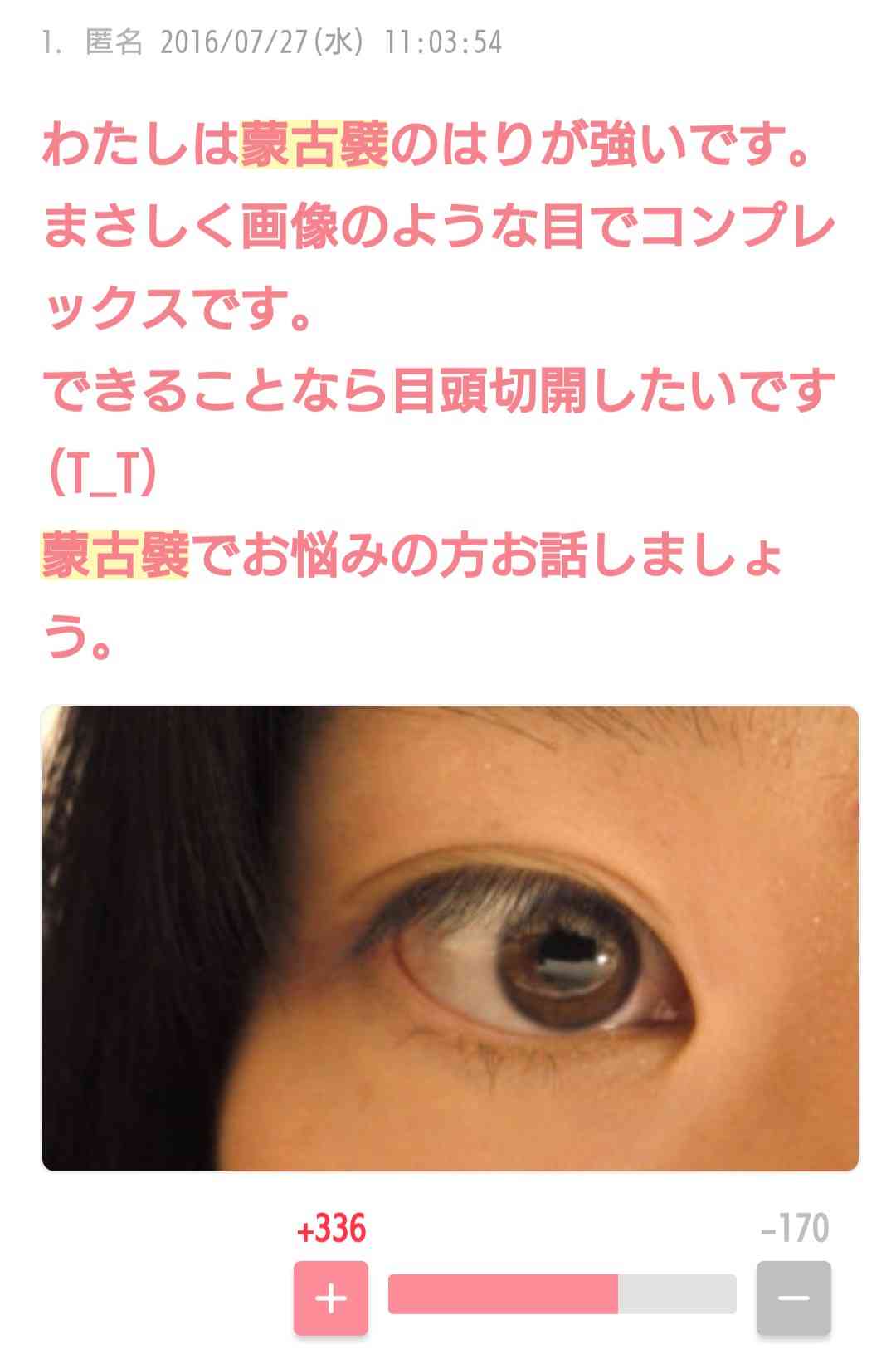 蒙古襞について語るトピ