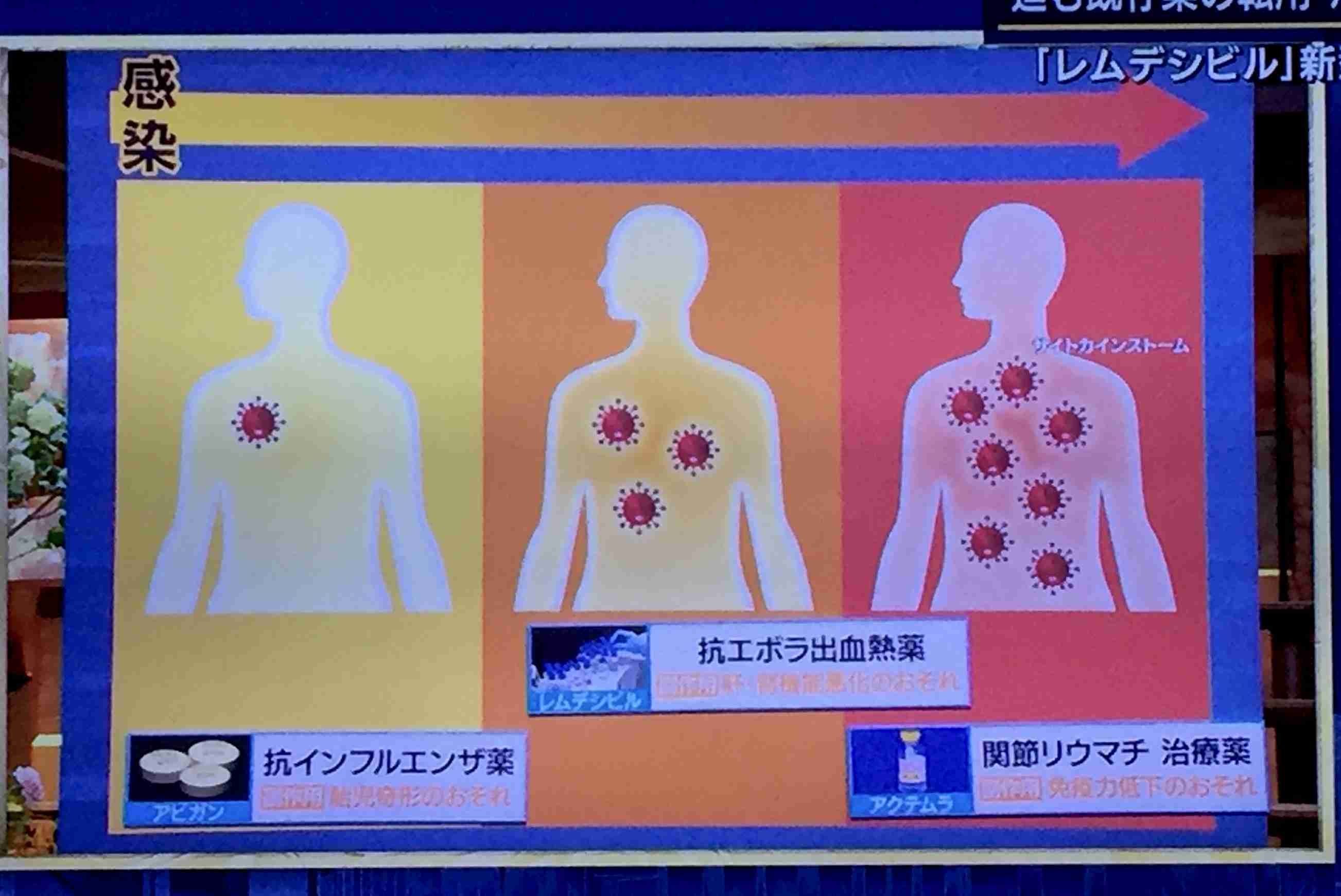 感染ゼロ続く17県で解除も　西村氏、非常事態宣言巡り