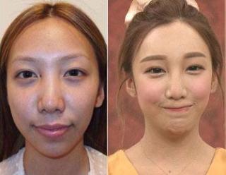 NGT48荻野由佳 “アベノマスク”に「給食マスクを思い出す」 フォロワーは「小顔やなぁ」