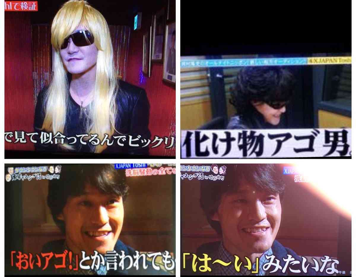 顎がおシャクレになられてる方 ガールズちゃんねる Girls Channel