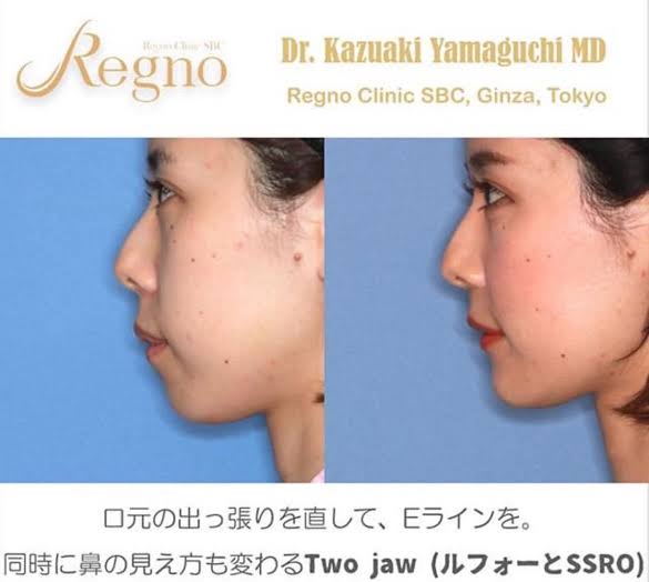 有村藍里、前髪のないイメチェン写真に称賛の声「大天使」「益々可愛いくて綺麗」