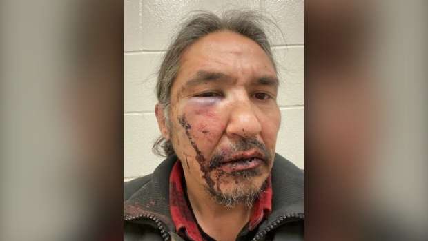 公園で運動中のフィリピン系女性に嫌がらせ、差別動画が拡散　米