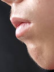 産毛は全処理しますか？