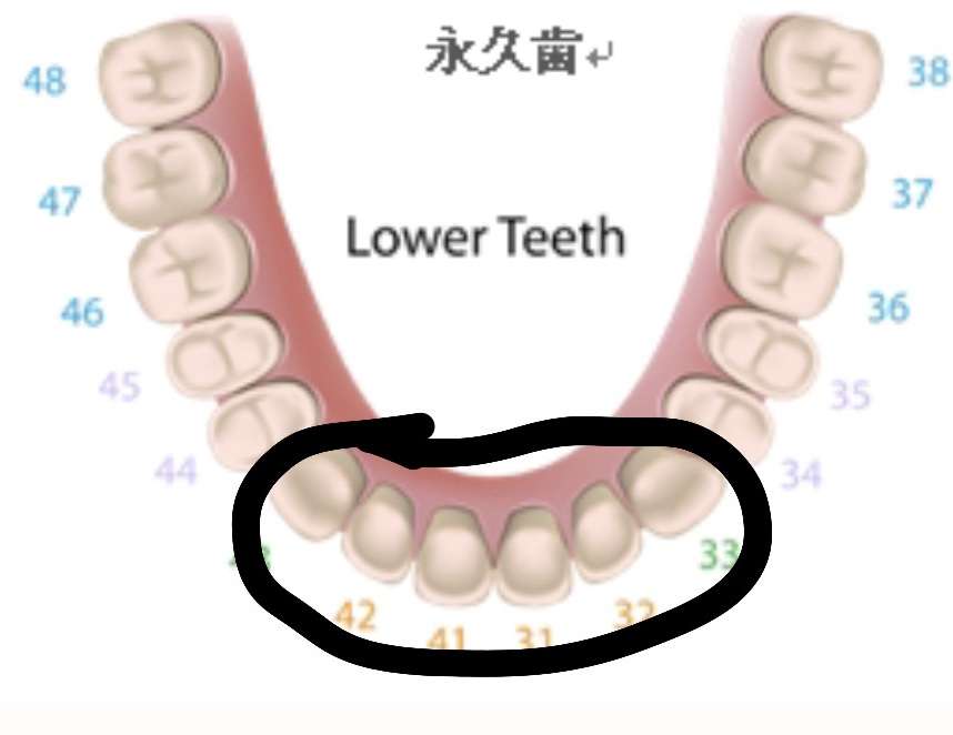 部分矯正したことがある人!