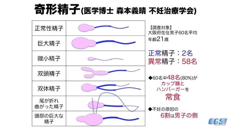 不妊の原因の半分は男性「自分のはずない」の思い込みが発見を遅らせる・専門医