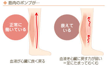 足がダルい!