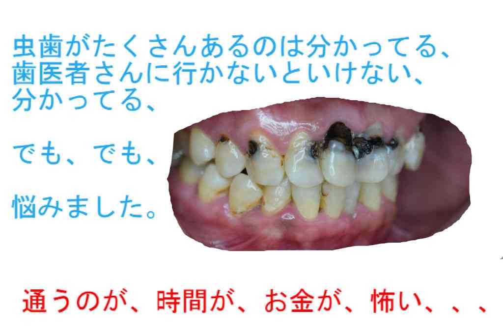 定期的に歯医者行きますか?