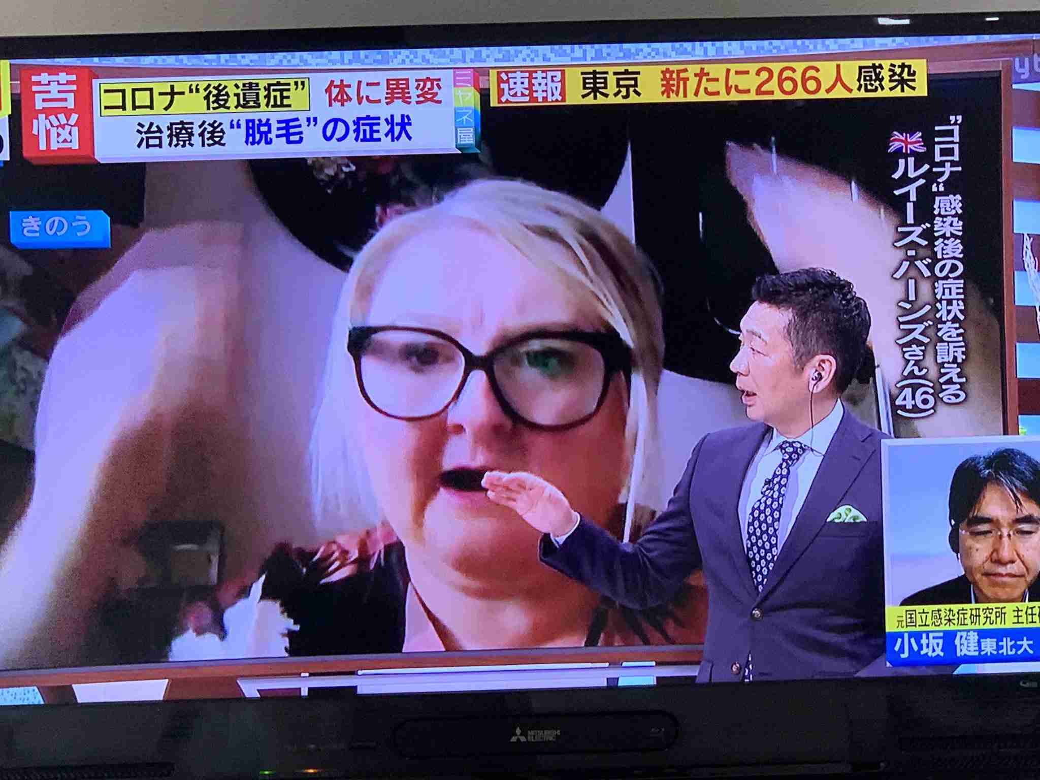 東京都で新たに270人程度感染　新型コロナ