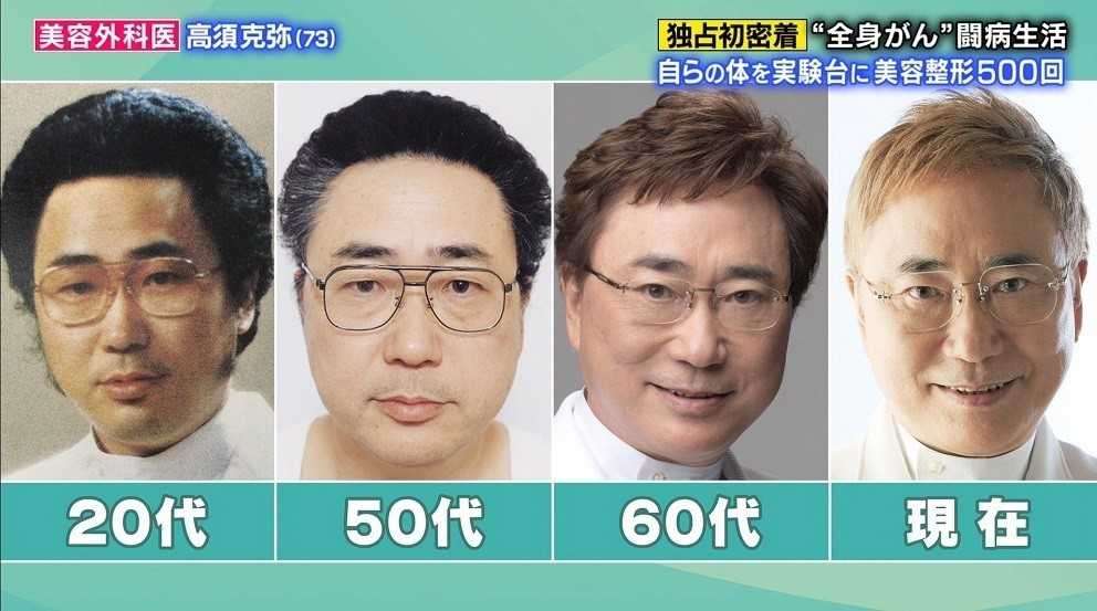 美容クリニックでのアンチエイジング　Part3