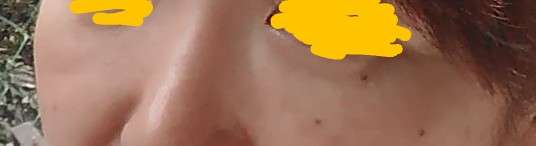 美容クリニックでのアンチエイジング　Part3