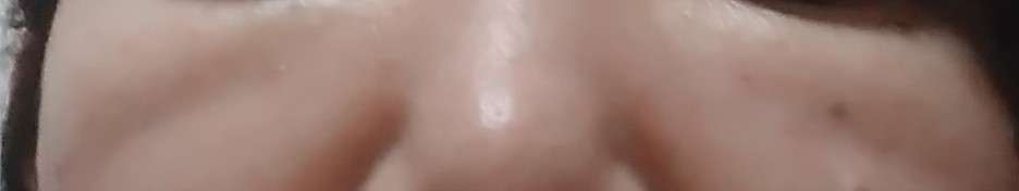美容クリニックでのアンチエイジング　Part3