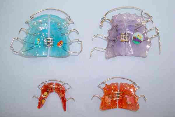 子供の歯の矯正