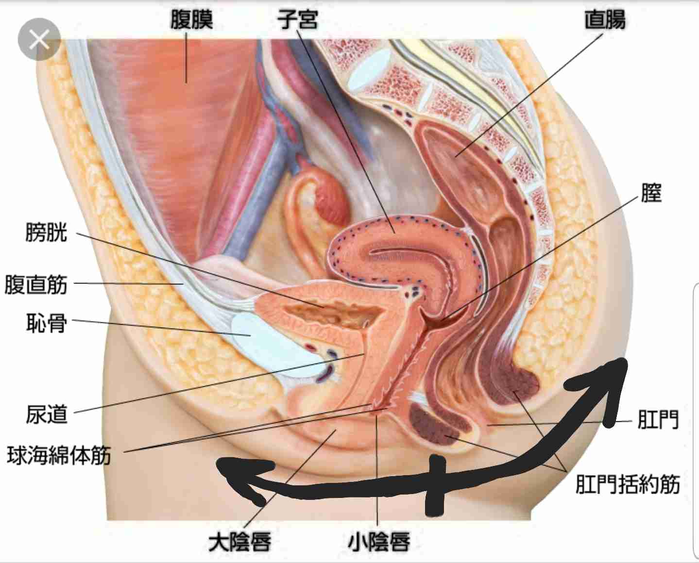 膀胱炎になりやすい人
