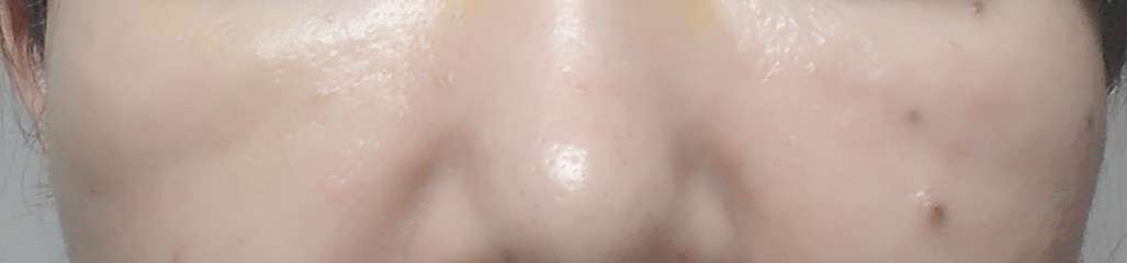 美容クリニックでのアンチエイジング　Part3
