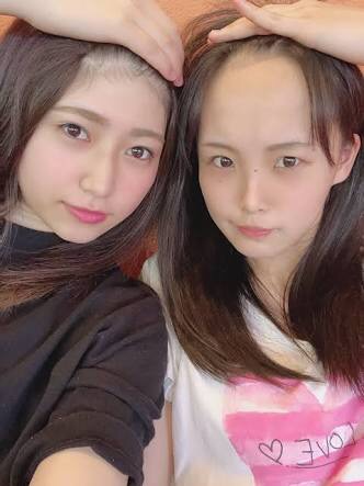 おでこが狭くて目の位置が高い人！