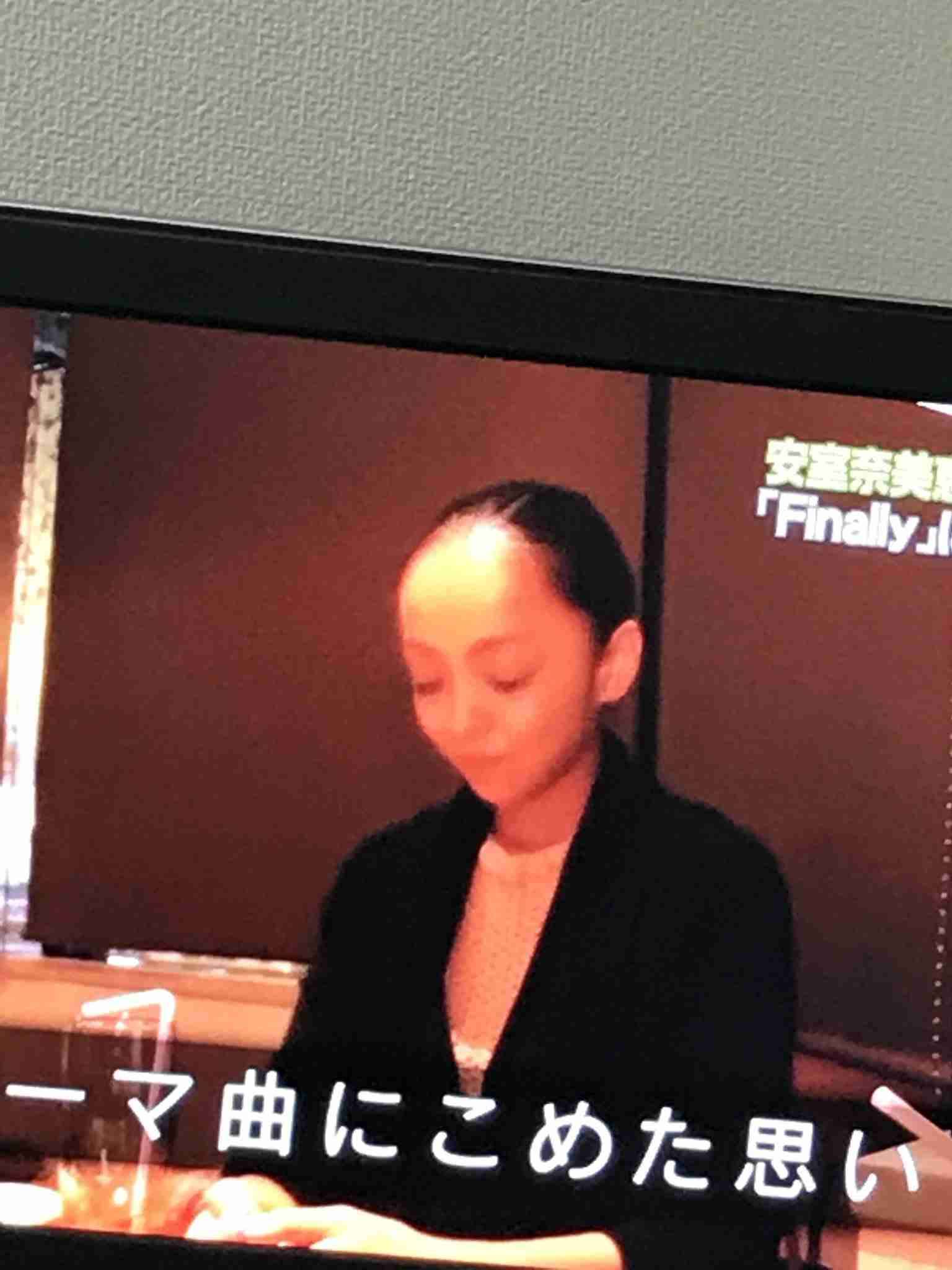 おでこが狭くて目の位置が高い人！