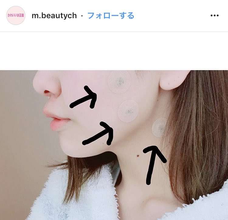 エラボトックスについて教えてください ガールズちゃんねる Girls Channel