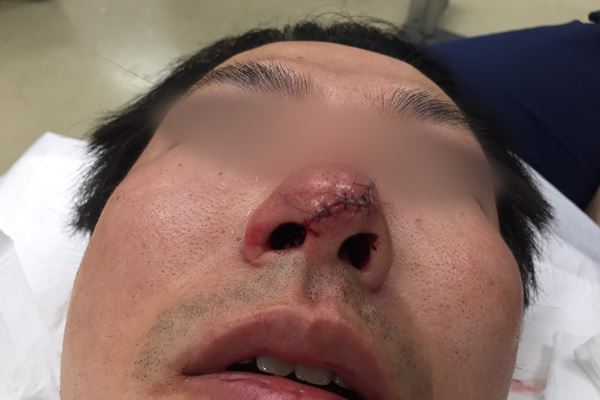 陣内孝則 フジ勤務の長男が傷害容疑で書類送検されていた!